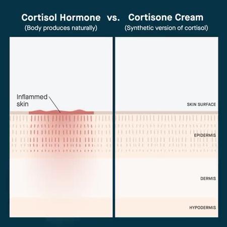 slmd super cortisone